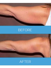 Vaser Clinic - Liverpool - Vaser Clinic - Liverpool