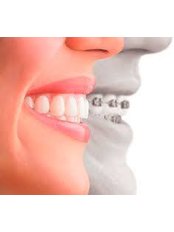 فيدانتام مجموعة من عيادات الأسنان - vedantam a group of dental clinics