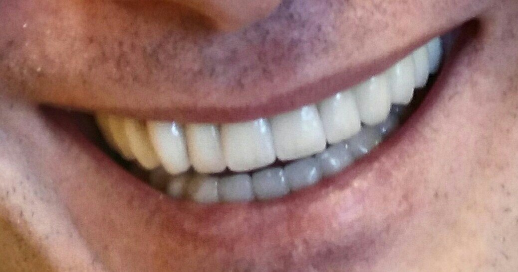 Vedra Dental 24/7 Holistic Clinic - Vedra Dental 24/7 Holistic Clinic