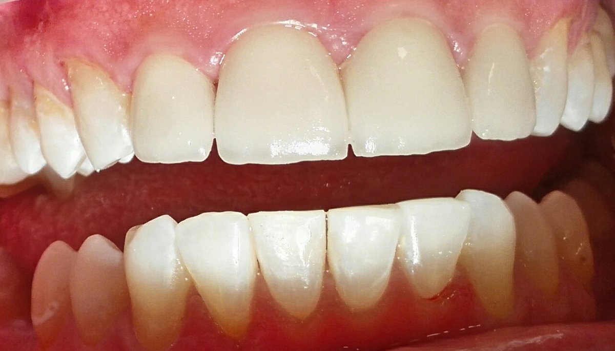 Vedra Dental 24/7 Holistic Clinic - Vedra Dental 24/7 Holistic Clinic