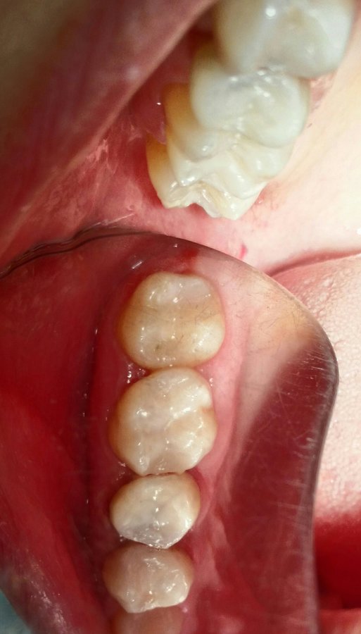 Vedra Dental 24/7 Holistic Clinic - Vedra Dental 24/7 Holistic Clinic