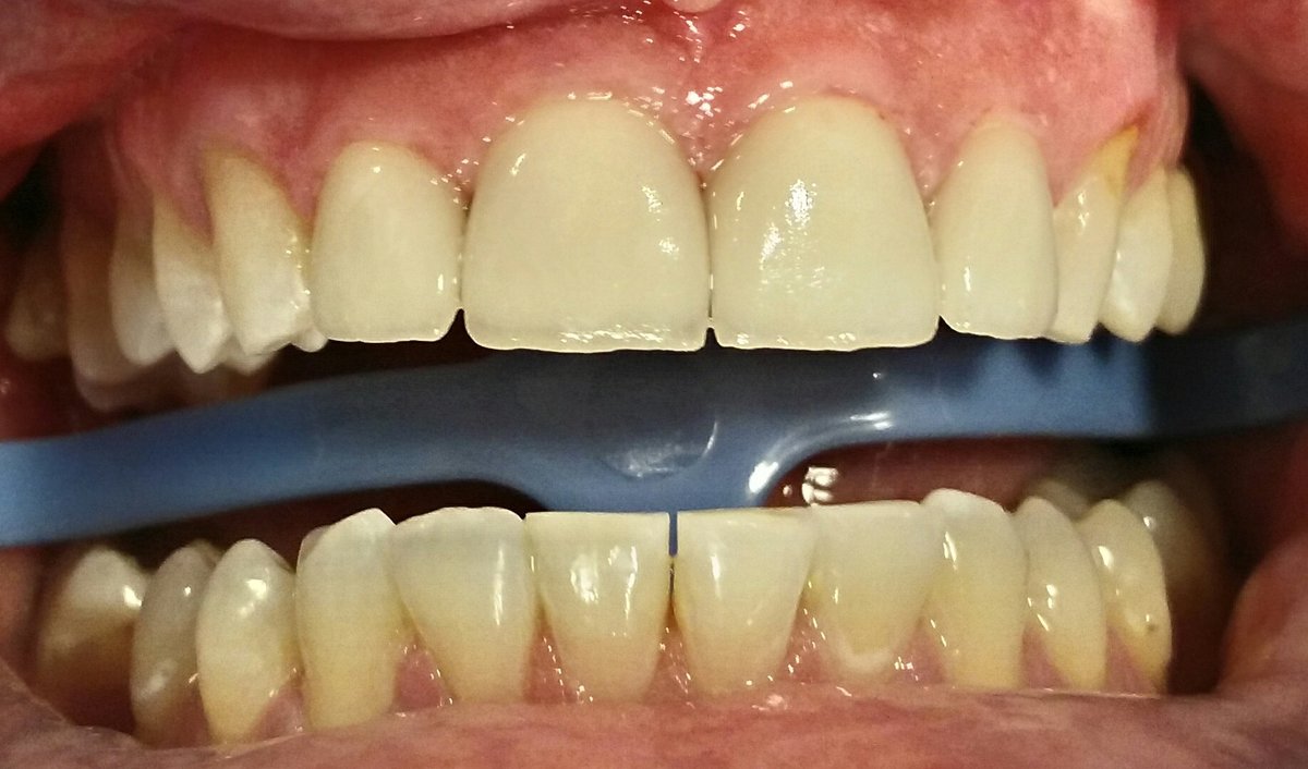 Vedra Dental 24/7 Holistic Clinic - Vedra Dental 24/7 Holistic Clinic