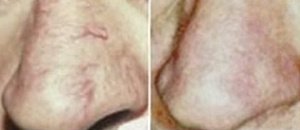 Vein Care - Vein Care