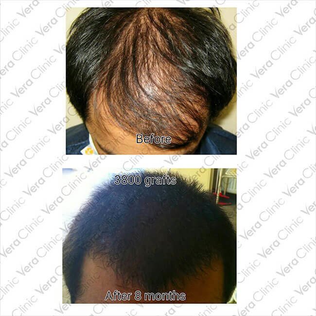 Vera Clinic - Vera Clinic