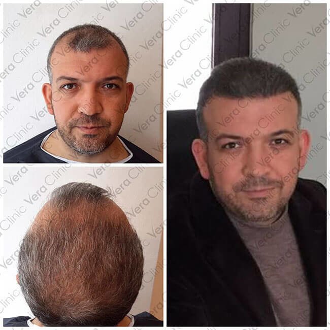 Vera Clinic - Vera Clinic