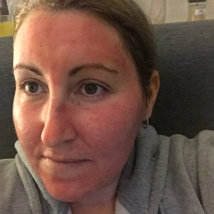 Victorian Cosmetic Dermal Clinic - Endeavour Hills - Victorian Cosmetic Dermal Clinic - Endeavour Hills