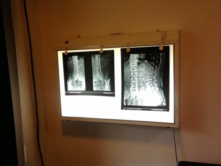 Vikalp Physiotherapy Clinic - Vikalp Physiotherapy Clinic