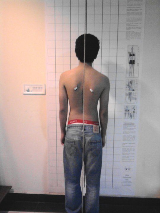 Vikalp Physiotherapy Clinic - Vikalp Physiotherapy Clinic