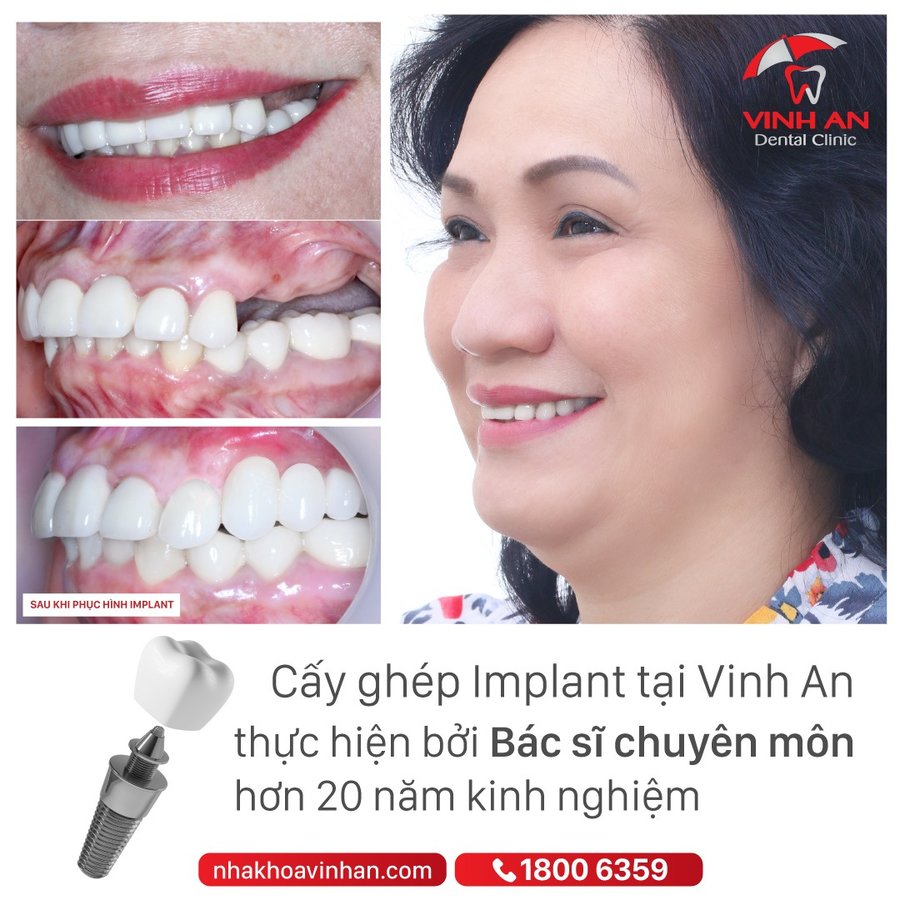 Vinh An Dental Clinic - Vinh An Dental Clinic