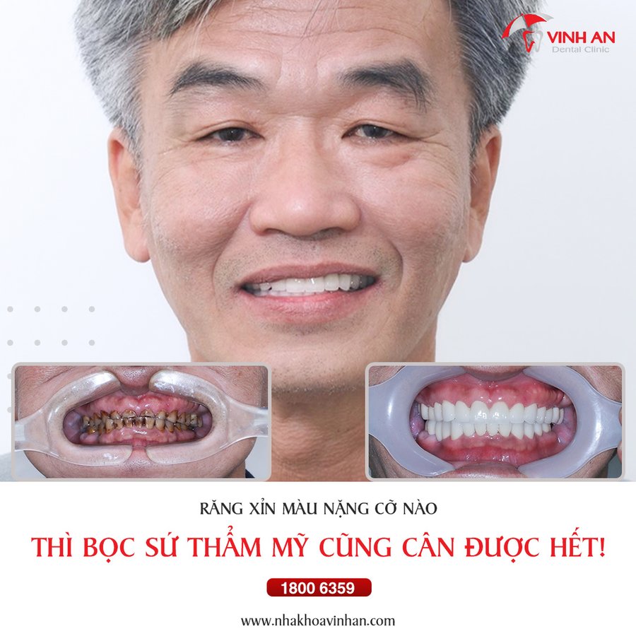 Vinh An Dental Clinic - Vinh An Dental Clinic