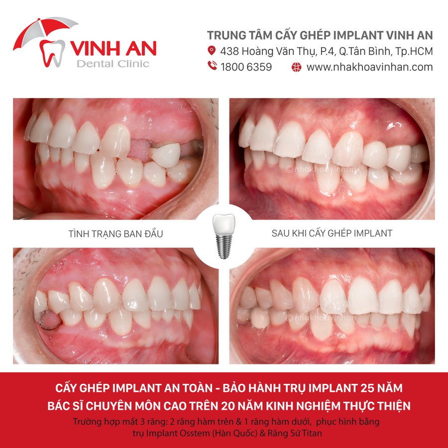 Vinh An Dental Clinic - Vinh An Dental Clinic