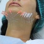 VIP Clinic - Narva - VIP Clinic - Narva