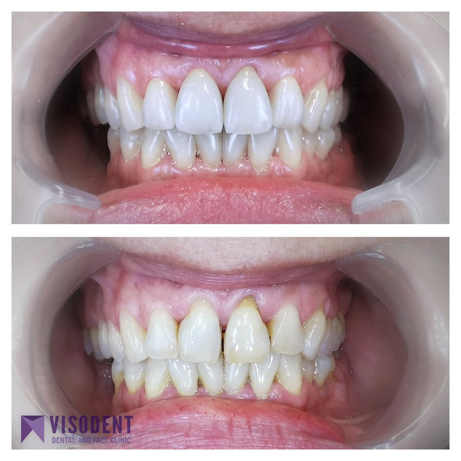 VISODENT Dental and Face Clinic - VISODENT Dental and Face Clinic