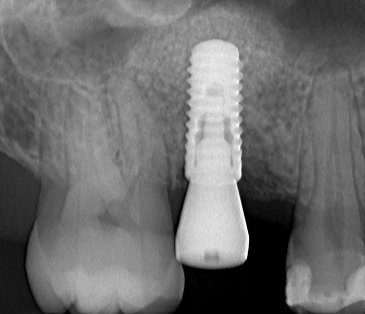 VISODENT Dental and Face Clinic - VISODENT Dental and Face Clinic