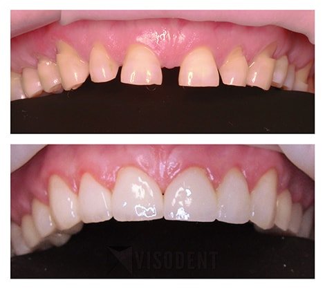 VISODENT Dental and Face Clinic - VISODENT Dental and Face Clinic