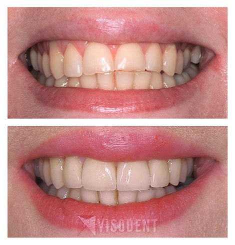 VISODENT Dental and Face Clinic - VISODENT Dental and Face Clinic