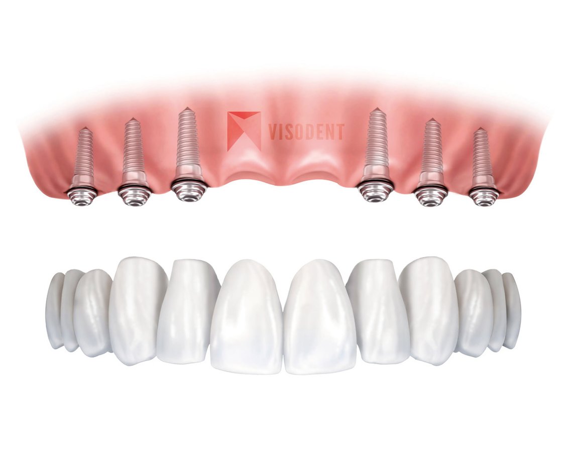 VISODENT Dental and Face Clinic - VISODENT Dental and Face Clinic