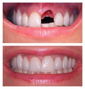 VISODENT Dental and Face Clinic - VISODENT Dental and Face Clinic