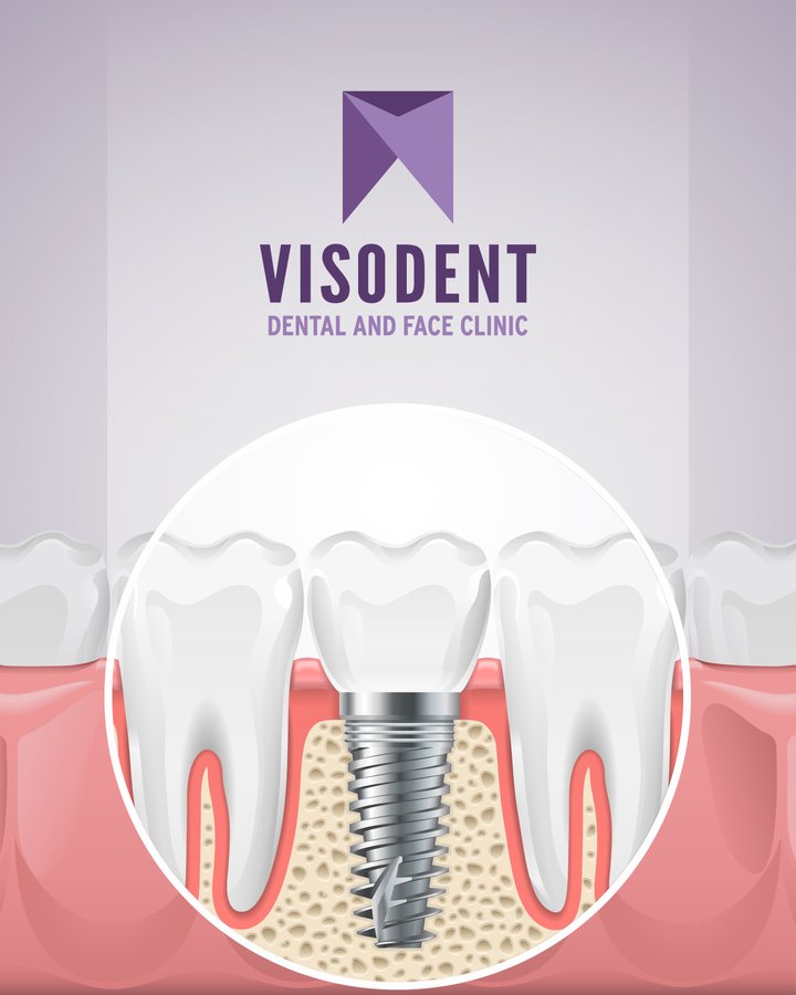 VISODENT Dental and Face Clinic - VISODENT Dental and Face Clinic