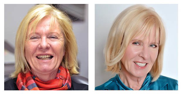 VitalEurope dentistry - Budapest & London - VitalEurope dentistry - Budapest & London