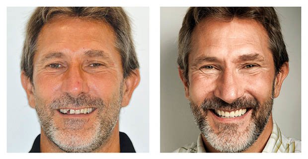 VitalEurope dentistry - Budapest & London - VitalEurope dentistry - Budapest & London