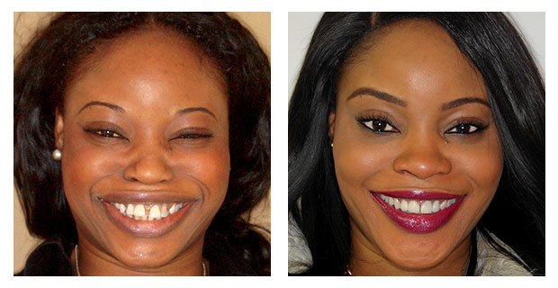 VitalEurope dentistry - Budapest & London - VitalEurope dentistry - Budapest & London
