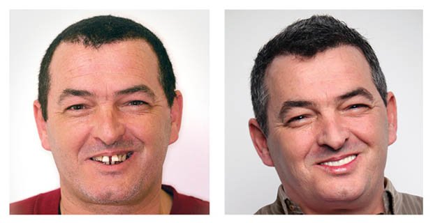 VitalEurope dentistry - Budapest & London - VitalEurope dentistry - Budapest & London