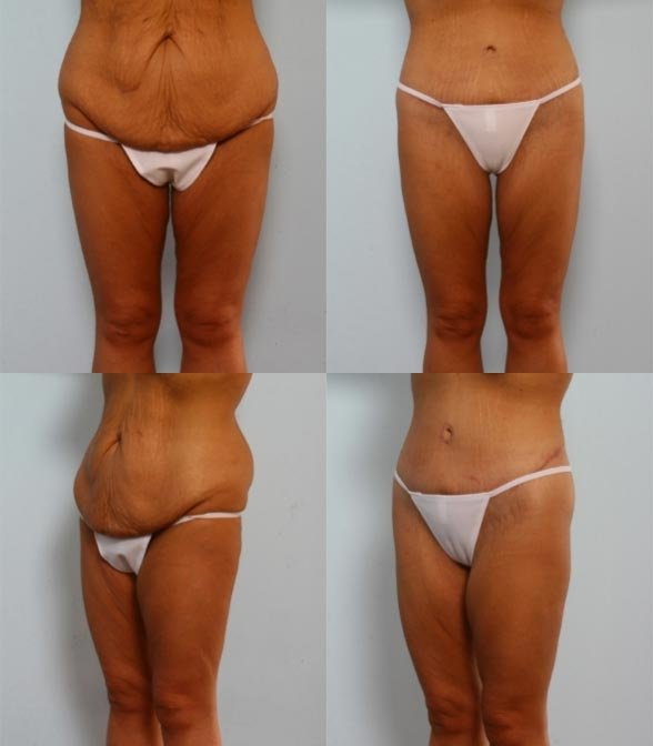 Vitenas Cosmetic Surgery - Vitenas Cosmetic Surgery