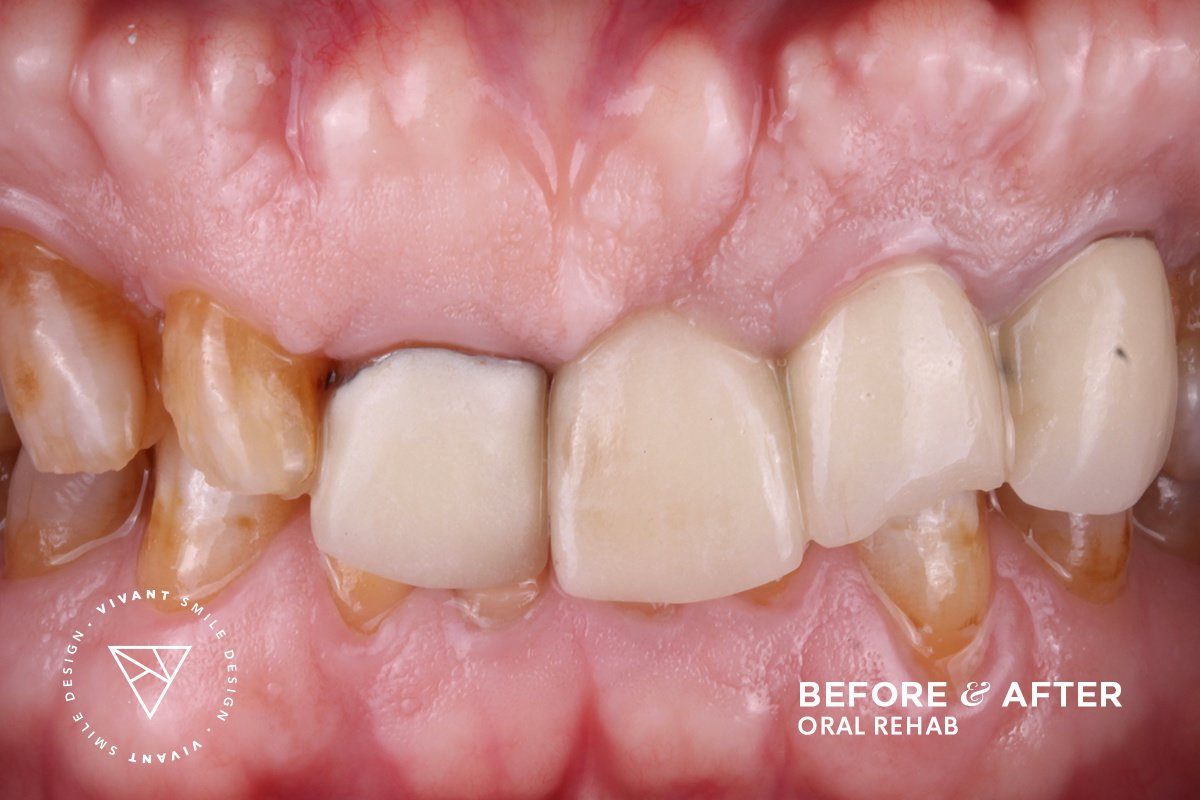 Vivant Smile Design - Vivant Smile Design