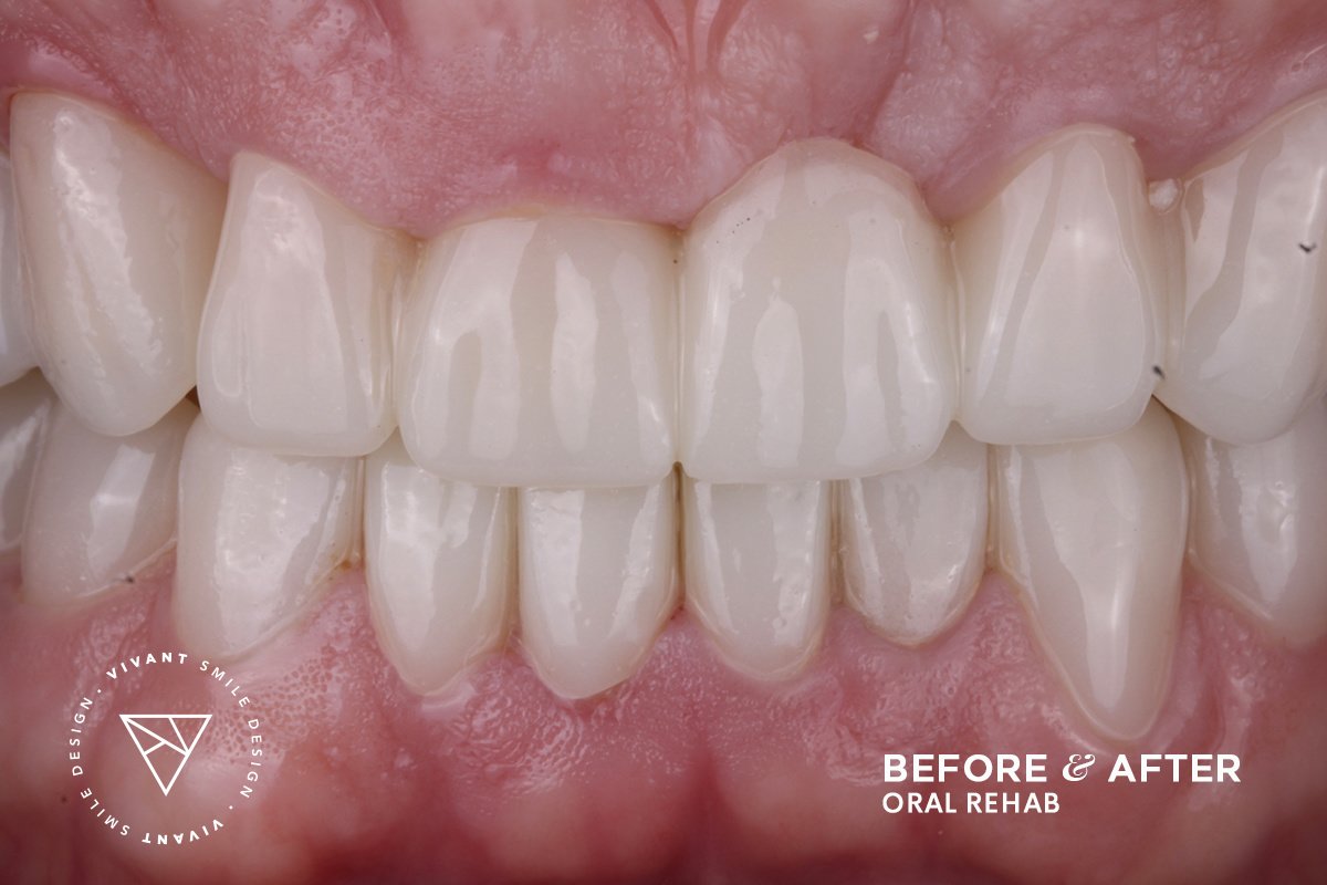 Vivant Smile Design - Vivant Smile Design