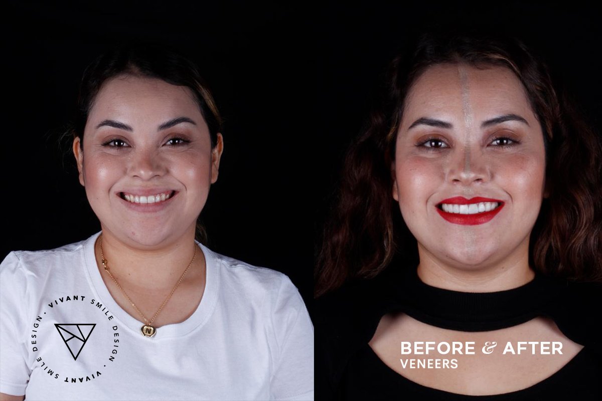 Vivant Smile Design - Vivant Smile Design