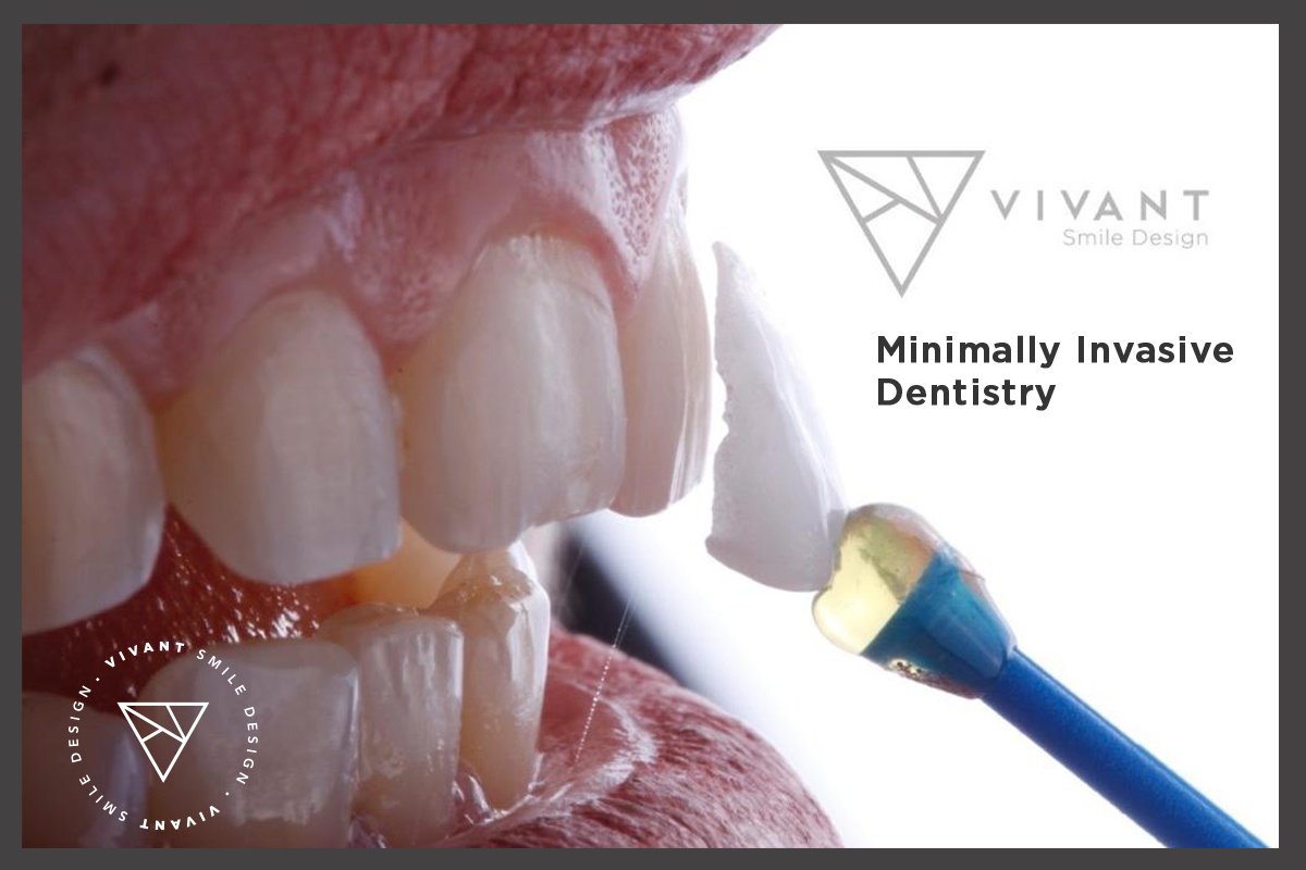 Vivant Smile Design - Vivant Smile Design