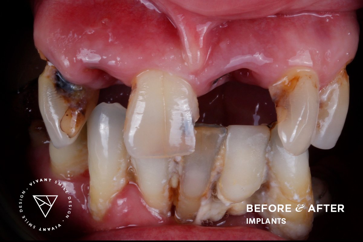 Vivant Smile Design - Vivant Smile Design