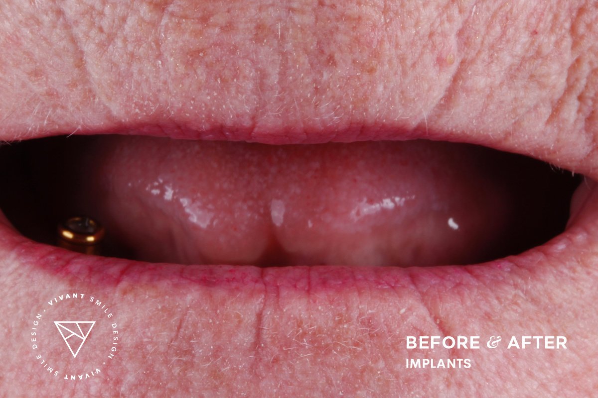 Vivant Smile Design - Vivant Smile Design