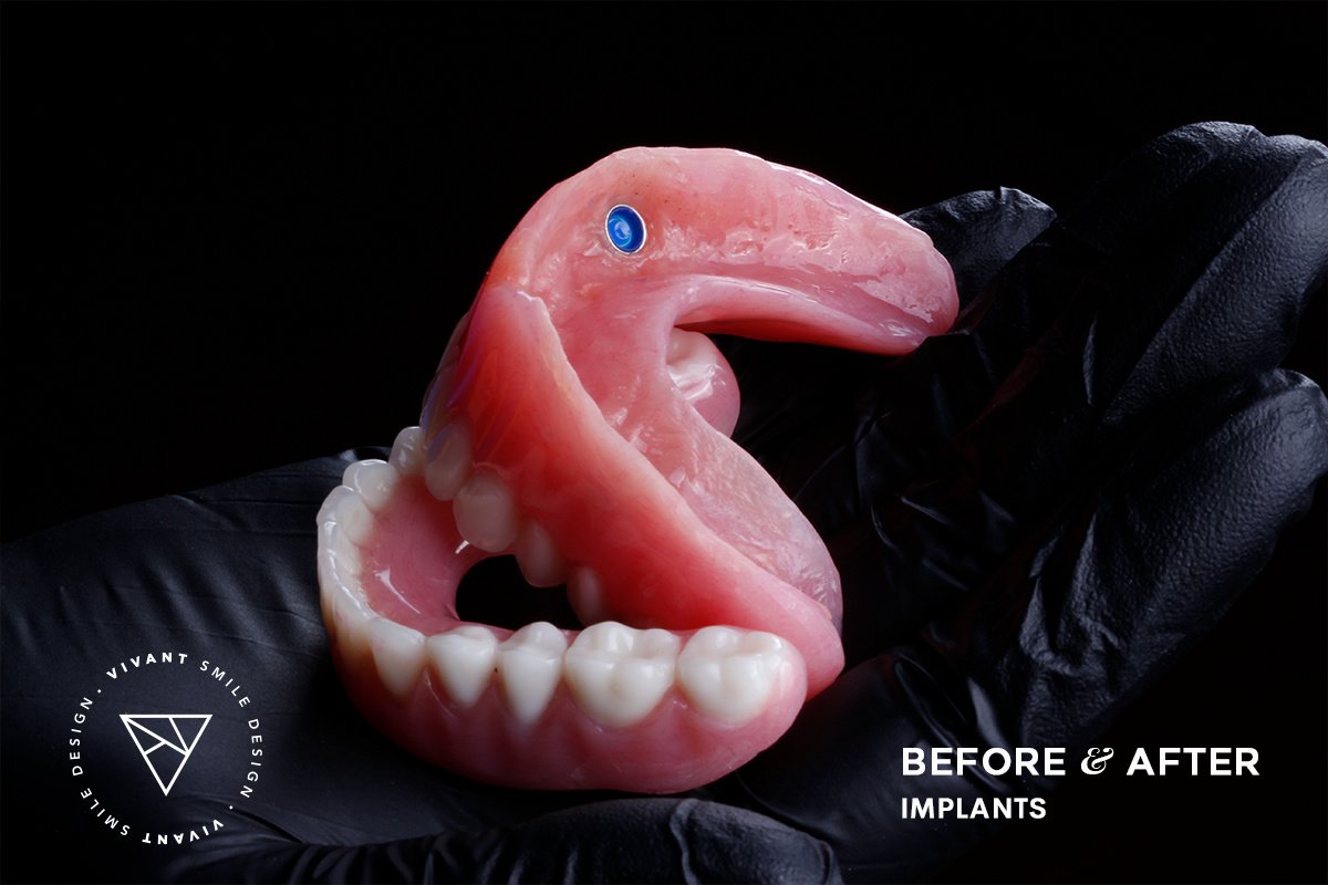 Vivant Smile Design - Vivant Smile Design