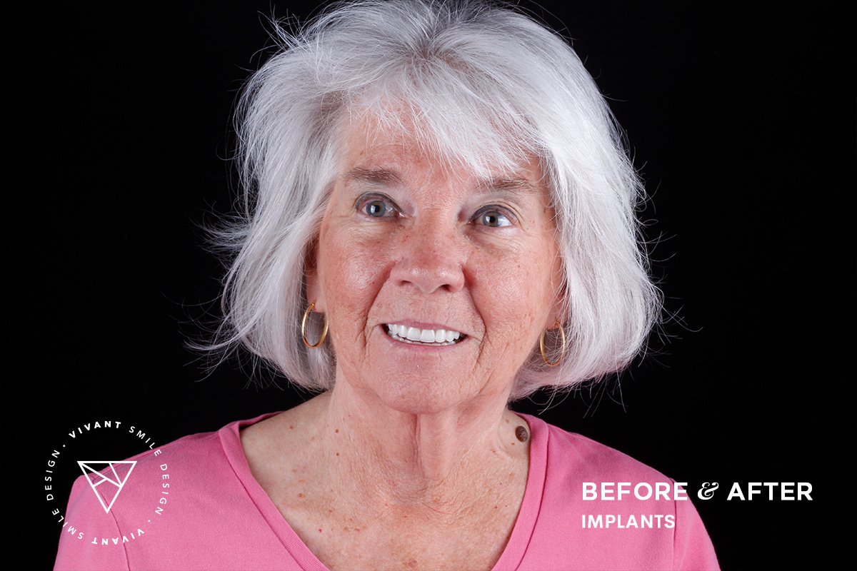 Vivant Smile Design - Vivant Smile Design