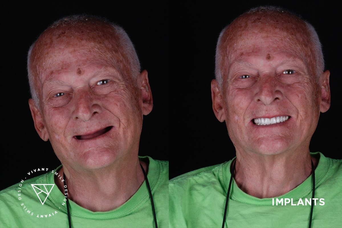 Vivant Smile Design - Vivant Smile Design