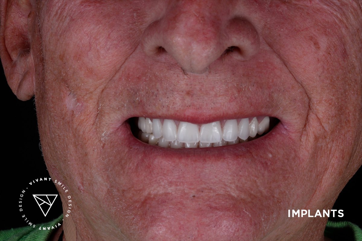 Vivant Smile Design - Vivant Smile Design