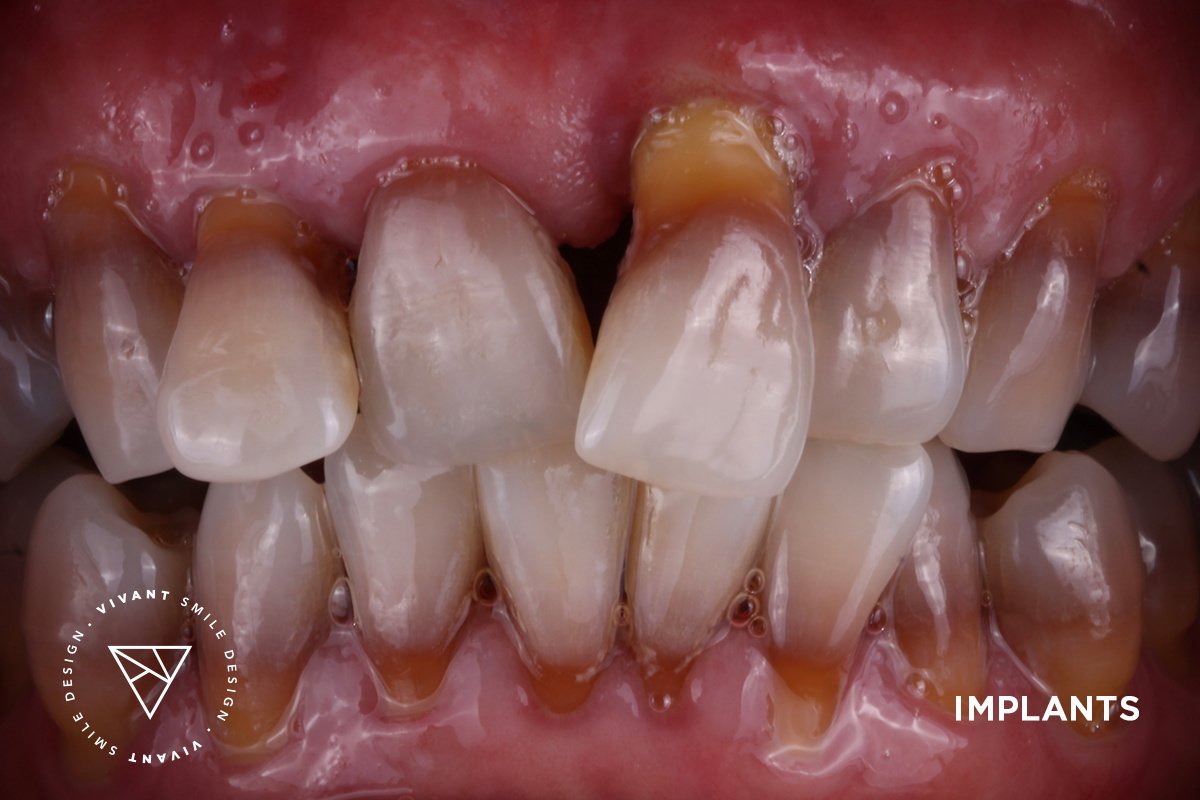 Vivant Smile Design - Vivant Smile Design