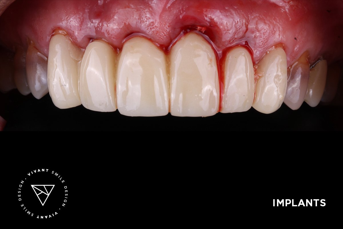 Vivant Smile Design - Vivant Smile Design