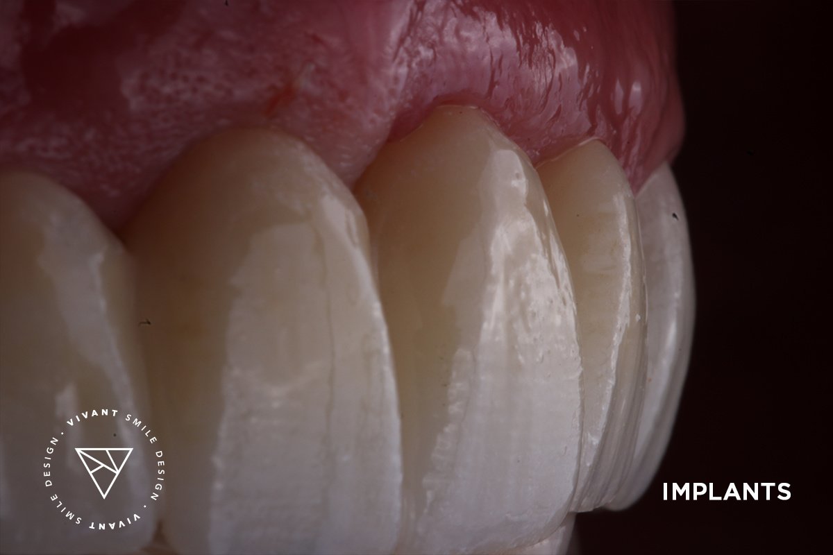 Vivant Smile Design - Vivant Smile Design
