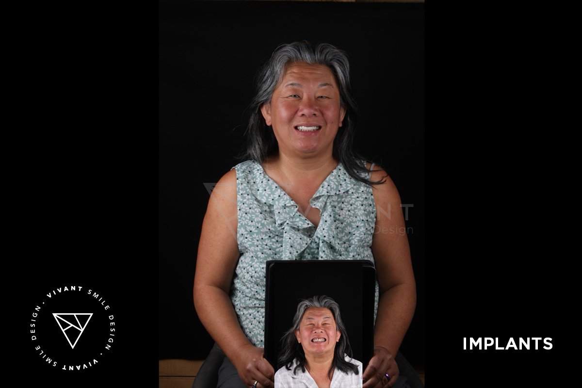 Vivant Smile Design - Vivant Smile Design