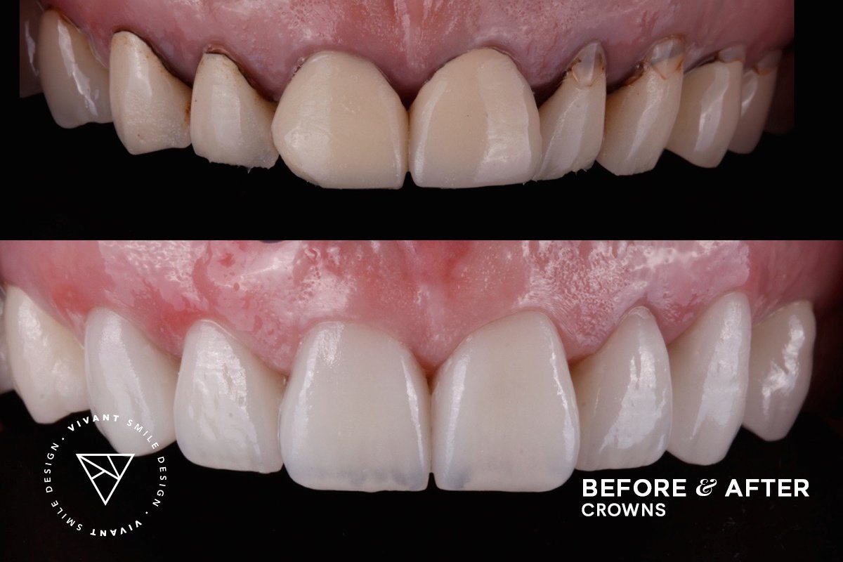 Vivant Smile Design - Vivant Smile Design