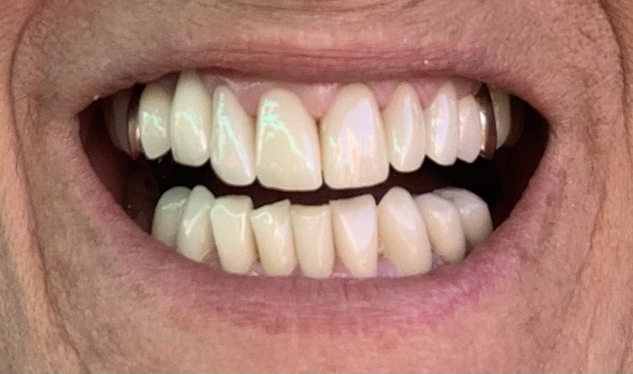 Vivant Smile Design - Vivant Smile Design