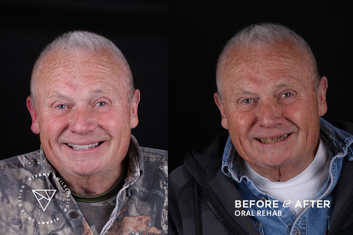 Vivant Smile Design - Vivant Smile Design