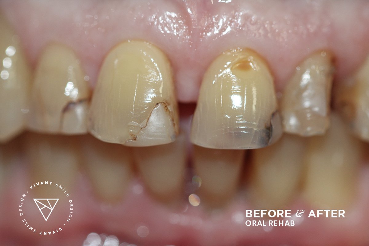 Vivant Smile Design - Vivant Smile Design