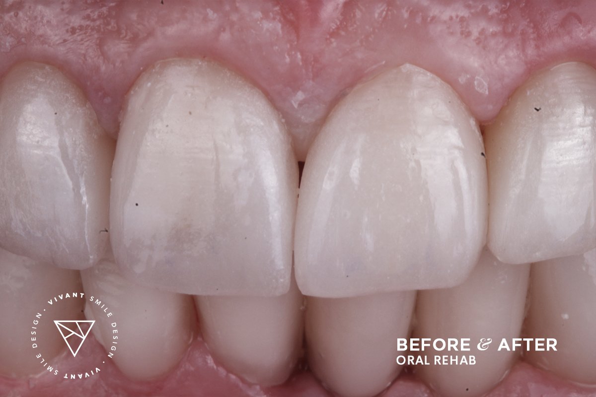Vivant Smile Design - Vivant Smile Design