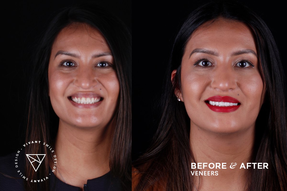 Vivant Smile Design - Vivant Smile Design