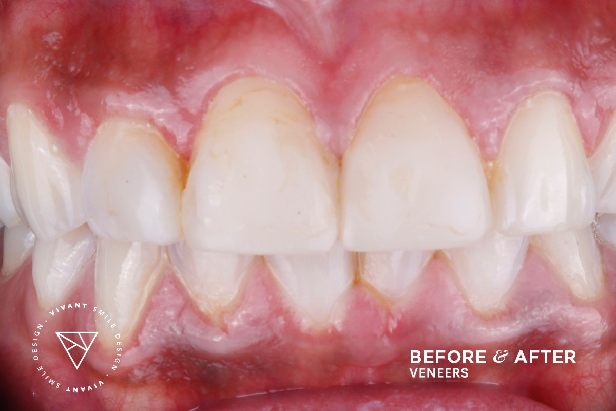 Vivant Smile Design - Vivant Smile Design