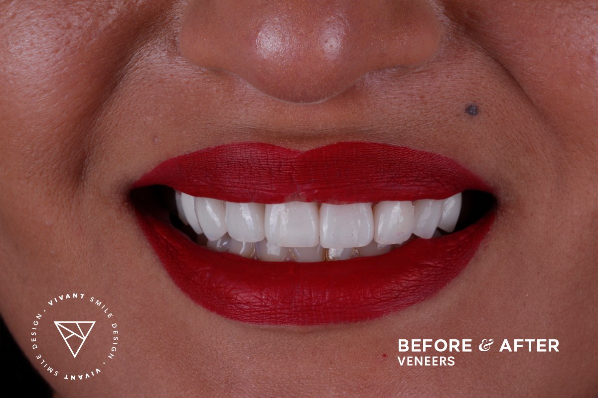 Vivant Smile Design - Vivant Smile Design